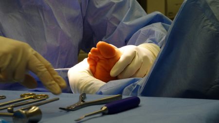 Gloved hands prepare for foot surgery in a sterile operating room environment.
