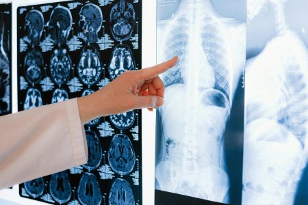 Radiographer needed in Leicester (Visa Sponsorship Available) A doctor pointing at a chest X-ray among MRI scans in a medical clinic.